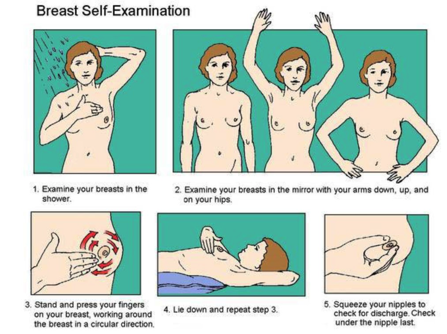 Breast cancer